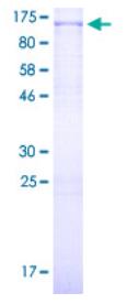 SDS-PAGE (FOXM1-4464H).jpg